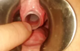 XXX Privado Gangbang videos orales gratis con un griego puta-Parte 1
